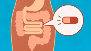 Probiyotik saçları nasıl etkiliyor