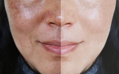 En iyi Arbutin Serum