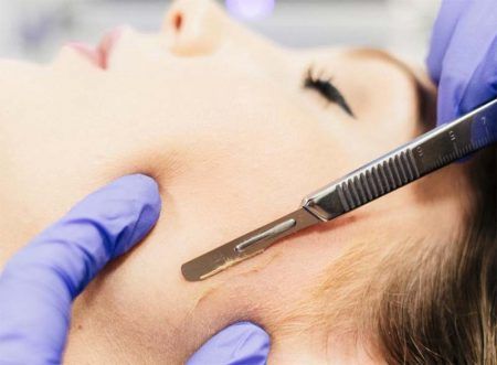 Dermaplaning nasıl yapılır