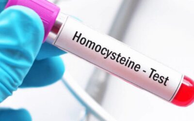 Homosistein Yüksekliği: Homosistein Kaç Olmalı?