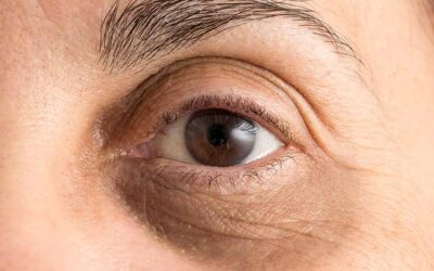 En İyi Göz Altı Morluk Kremi