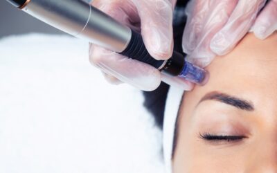 Dermapen Nedir? Dermapen Kimlere Yapılmaz?