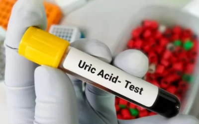 Ürik Asit Nasıl Düşer? Sarımsak Ürik Asiti Yükseltir mi?