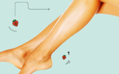 Çilek Bacak Görünümü Geçer mi? Peeling Etkili mi?
