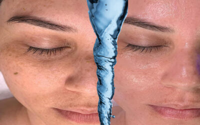 Hydrafacial Cilt Bakımı Sıralaması, Nasıl uygulanır?