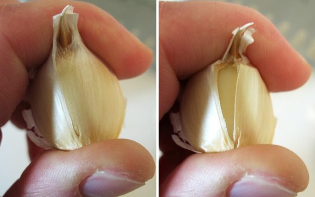 Parmağa Sarımsak Bağlamak Ne İşe Yarar? Nasıl Yapılır?