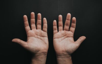 Avuç İçi Yanması Neden Olur? Nasıl Geçer?