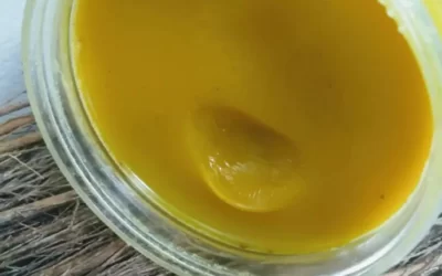 Deve Kuşu Yağı Kremi Faydaları Neler? Vitiligo için Etkili mi?