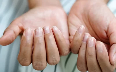 Tırnaklarım Çok İnce Ne Yapabilirim?