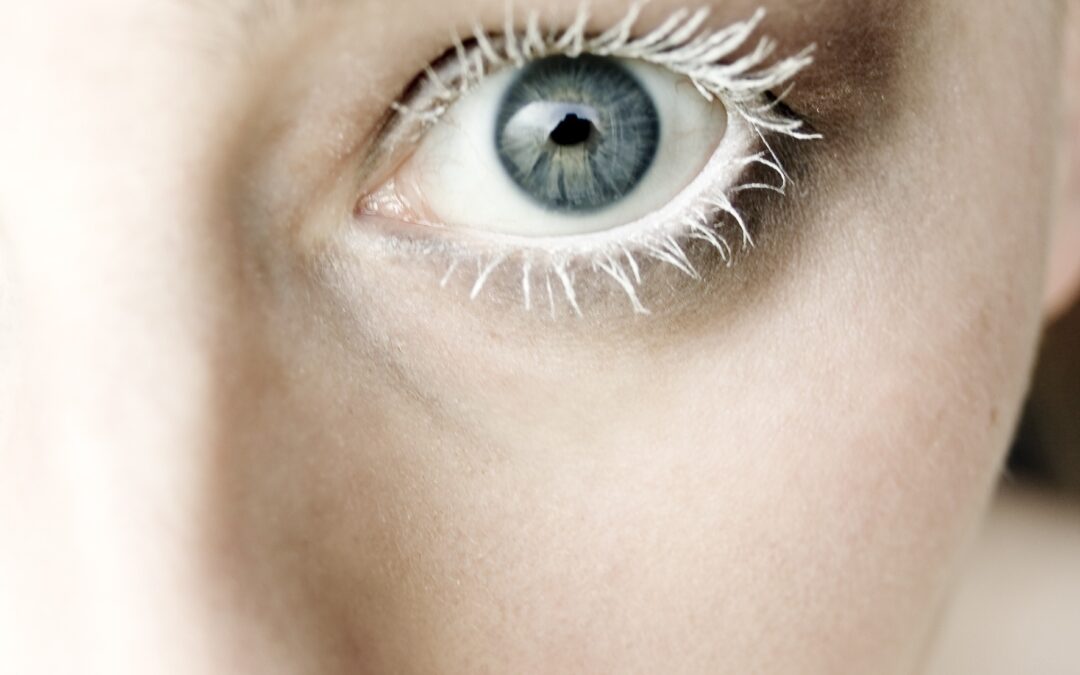 Kirpik dibi iltihabı bebe şampuanı