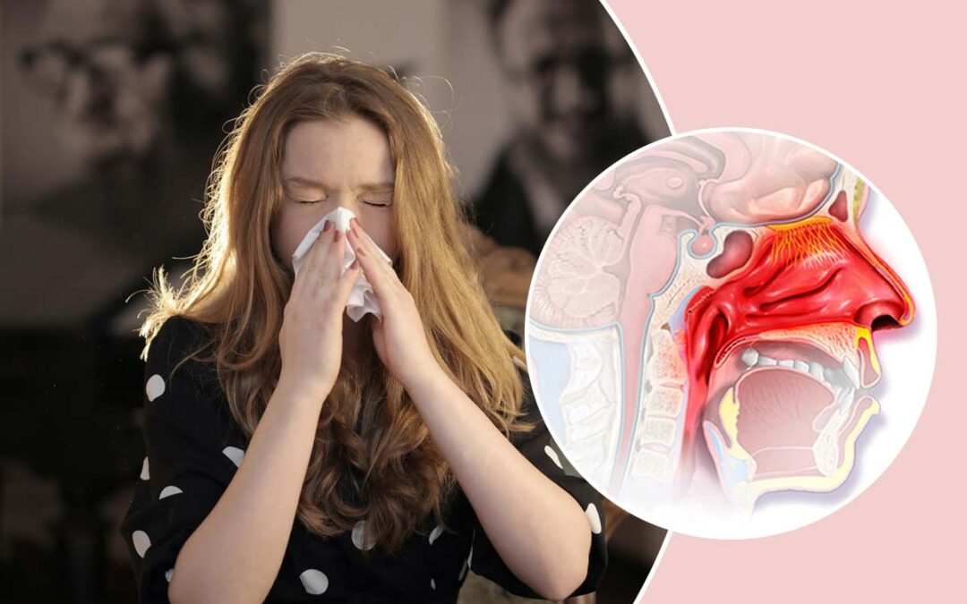 Alerjik Rinit ve Alerjik Olmayan Rinit Nedir?