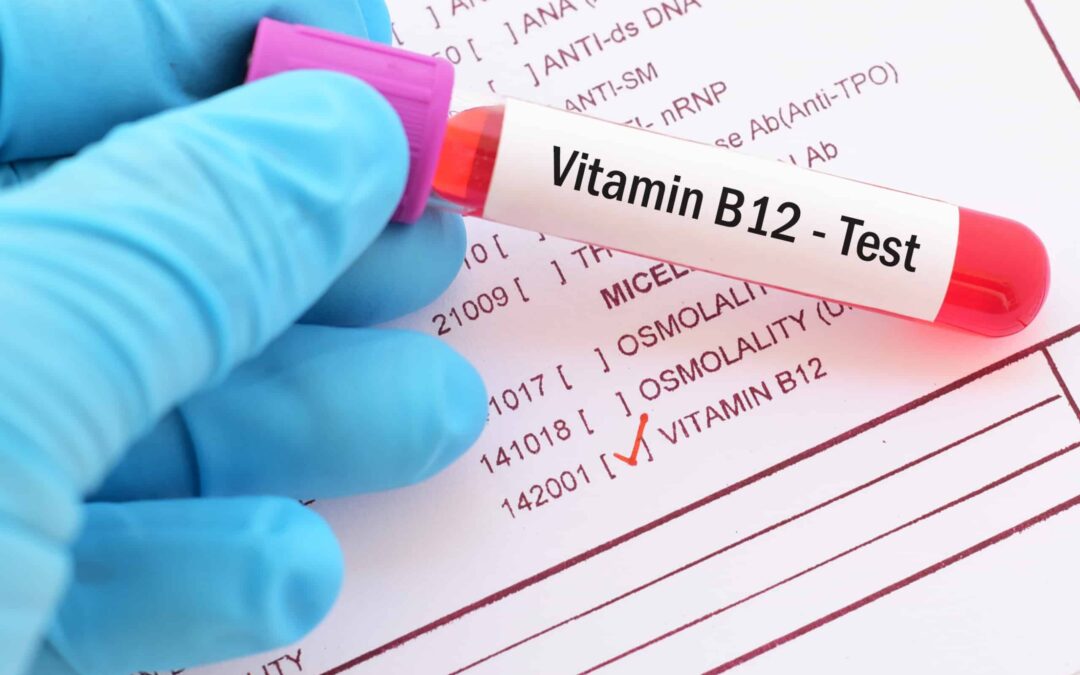 B12 Vitamini Kaç Olmalı?