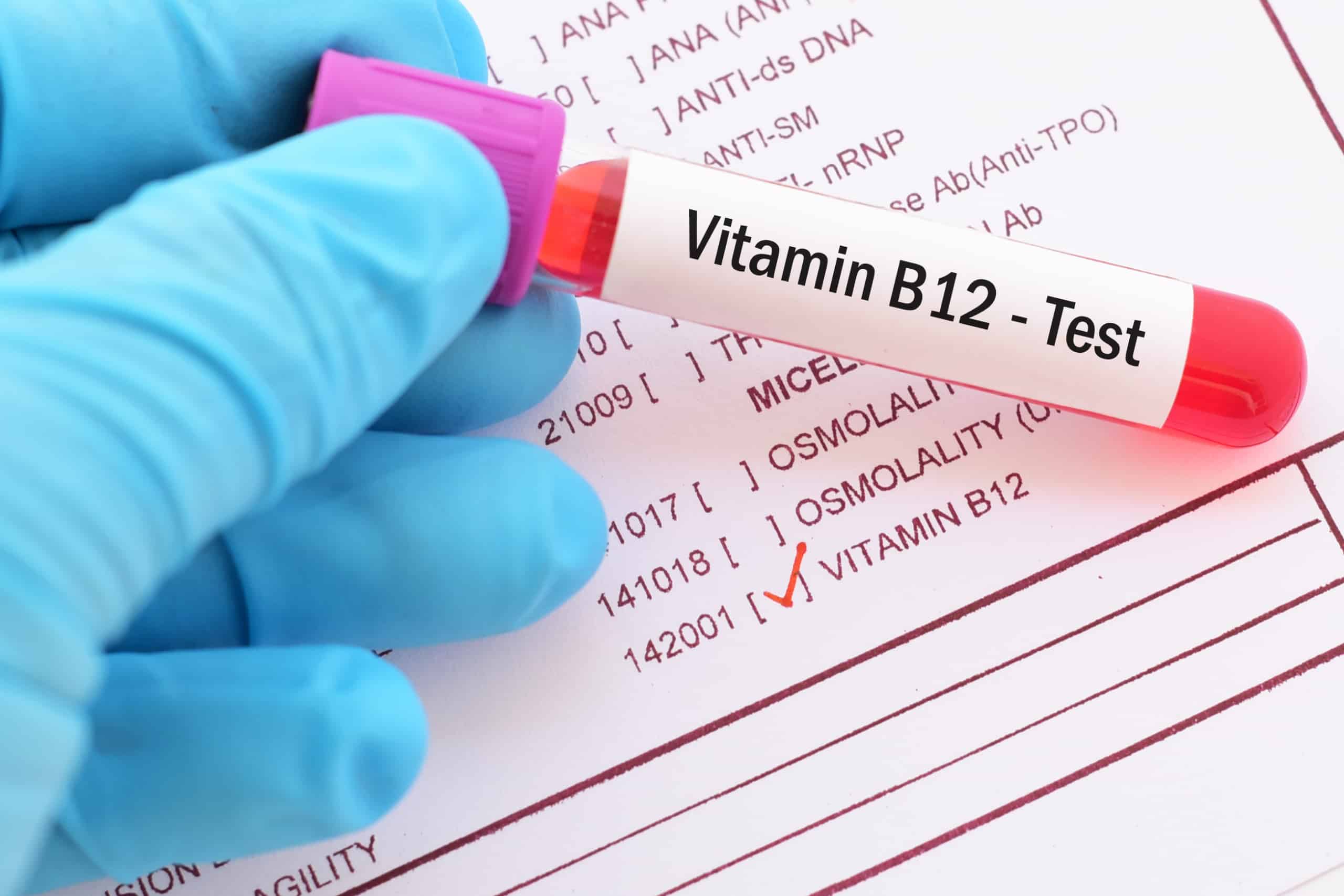 B12 Vitamini Kaç Olmalı?