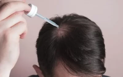 Minoxidil Nedir? Ne İçin Kullanılır?