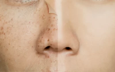 Arbutin Serum Nasıl Kullanılır? Ne İşe Yarar?