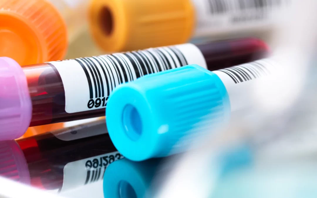stres hormonu testi nedir
