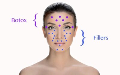 Botoks ve Dolgu Farkı Nedir?