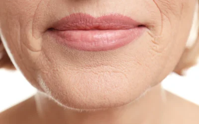 Dudak Üstü Çizgiler için Yüz Yogası