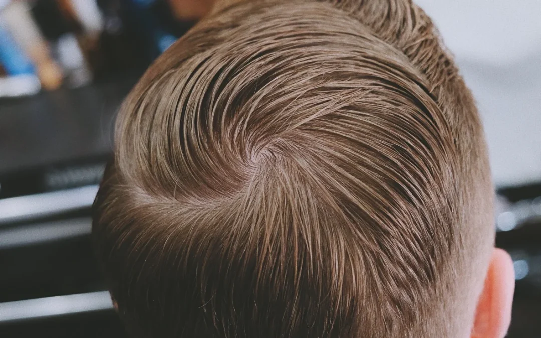 Cowlick Nedir? Nasıl Düzeltilir?