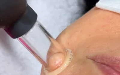 Yüz Kupalama Nedir? Nasıl Yapılır?