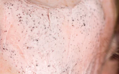 Tüy Dökücü Bakla Maskesi