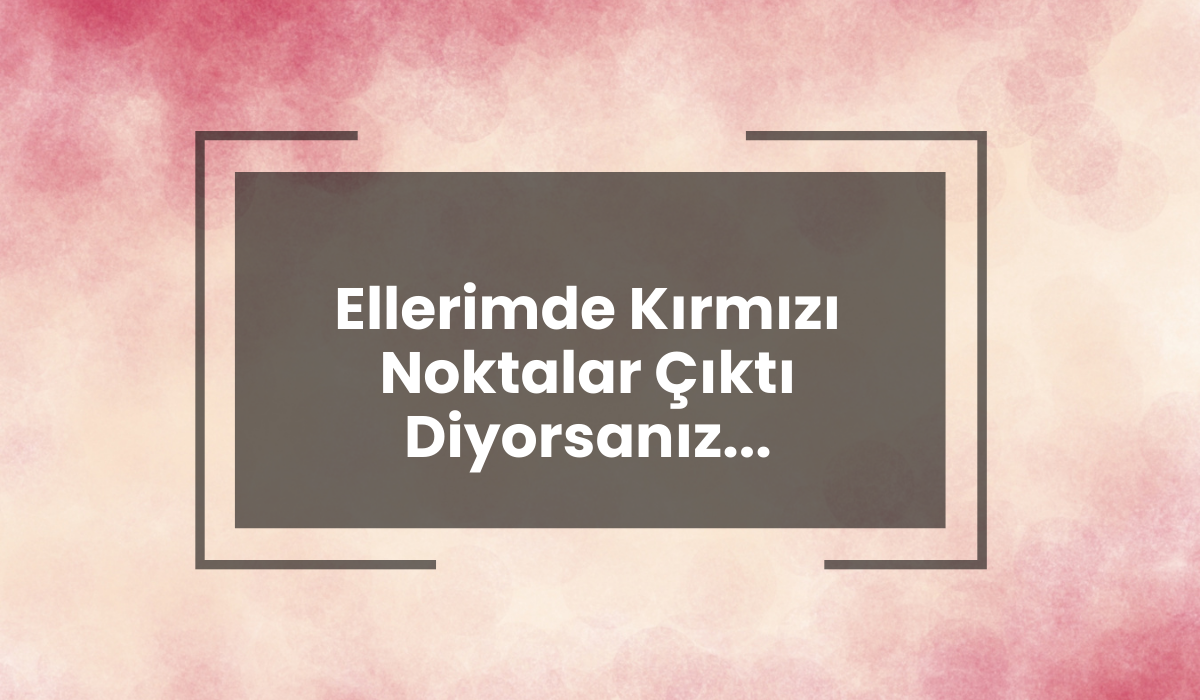 Ellerimde Kırmızı Noktalar Çıktı